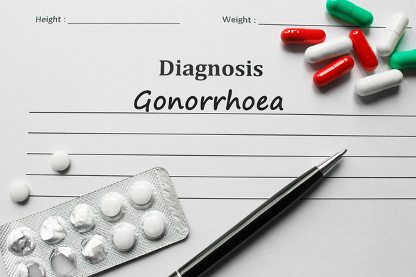 Gonorrhoea Diagnosis & testing