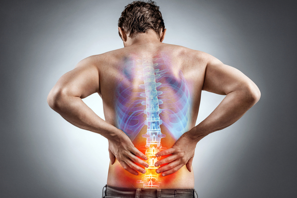 back pain and the importance of mri scanning