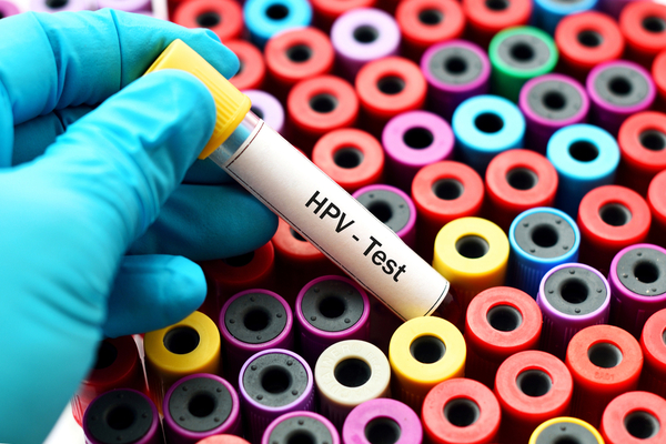 Test results for HPV virus