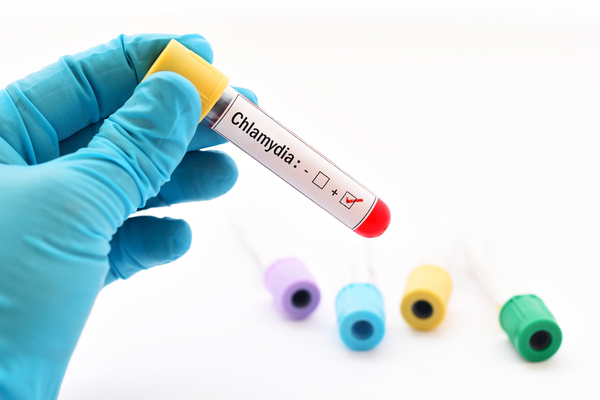 Chlamydia testing