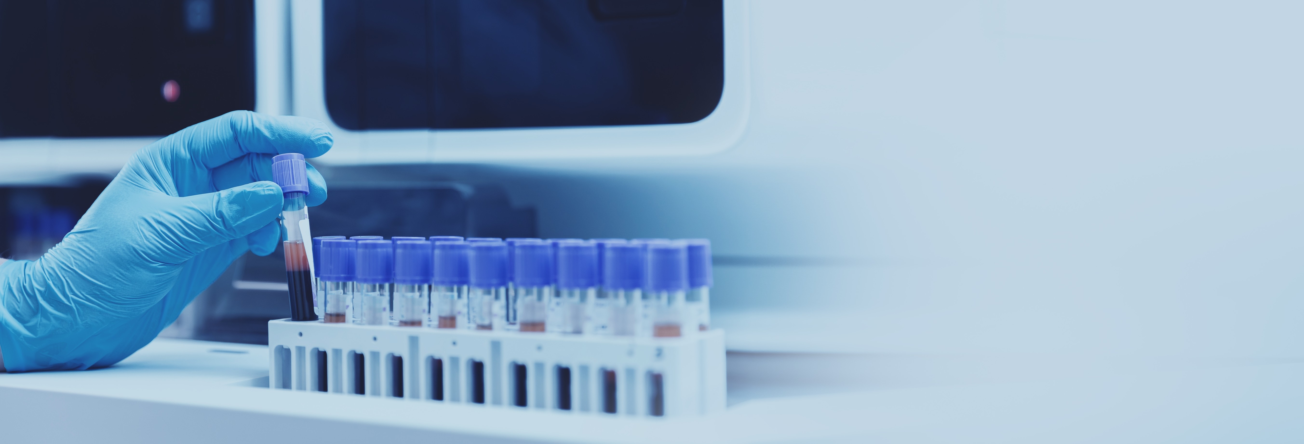 Private GP tests at Samedaydoctor featured image